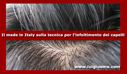 Infoltimento capelli per uomo donna di per uomo donna Gorizia Pordenone Trieste Udine di modello 2